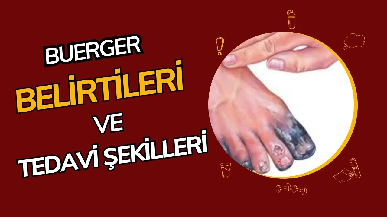 Buerger Hastalığı Nedir? Belirtileri, Nedenleri ve Tedavi Yöntemleri