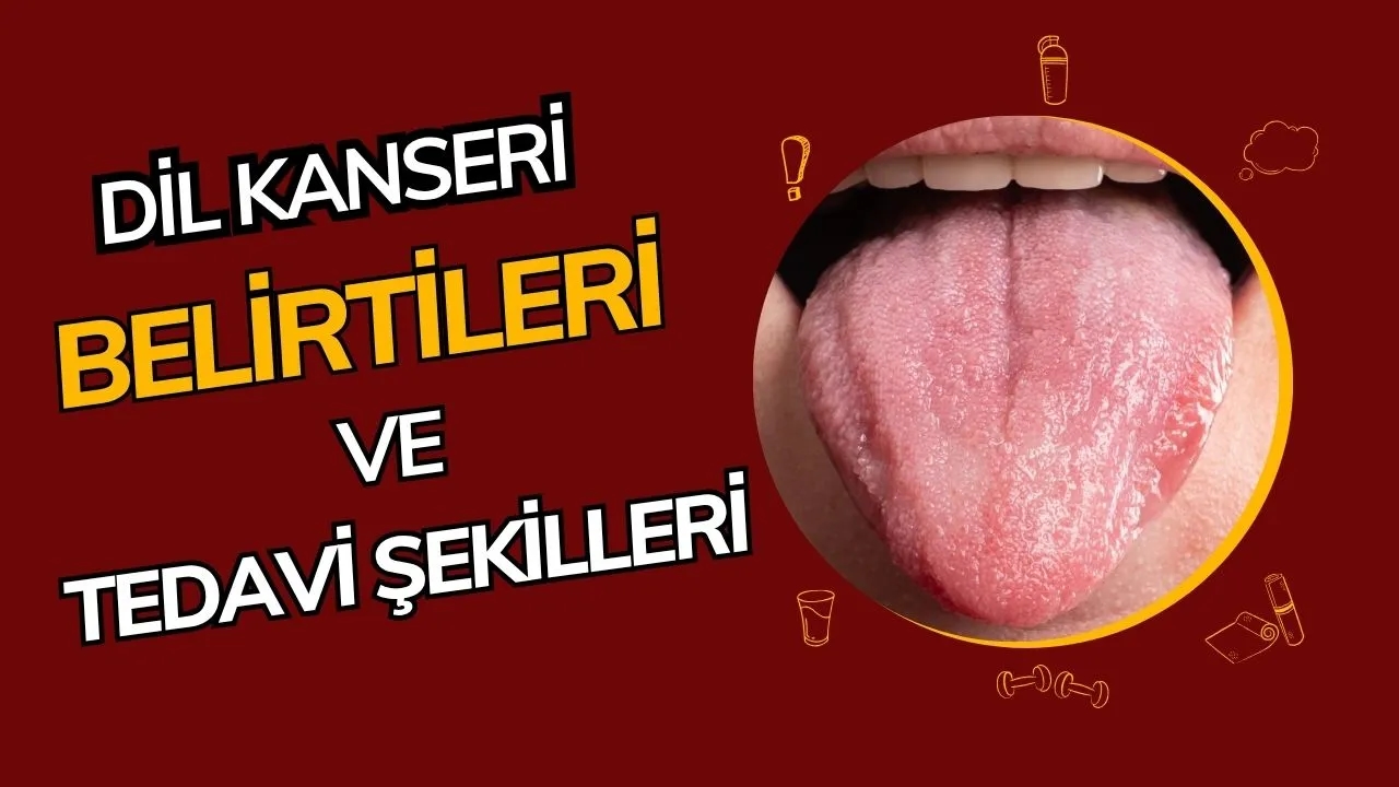 Dil Kanseri Nedir? Belirtileri, Tanısı ve Tedavi Yöntemleri