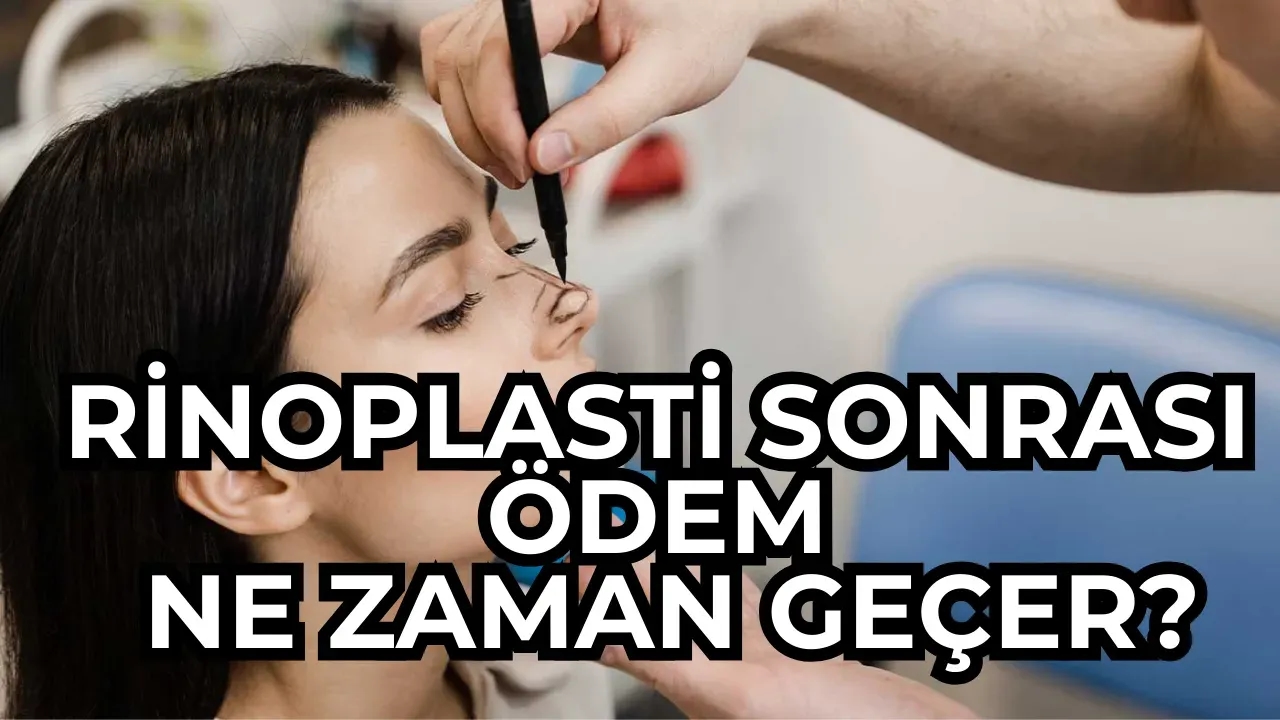 Burun Ameliyatı Sonrası Şişlik Ne Zaman İner? Etkili Çözümler