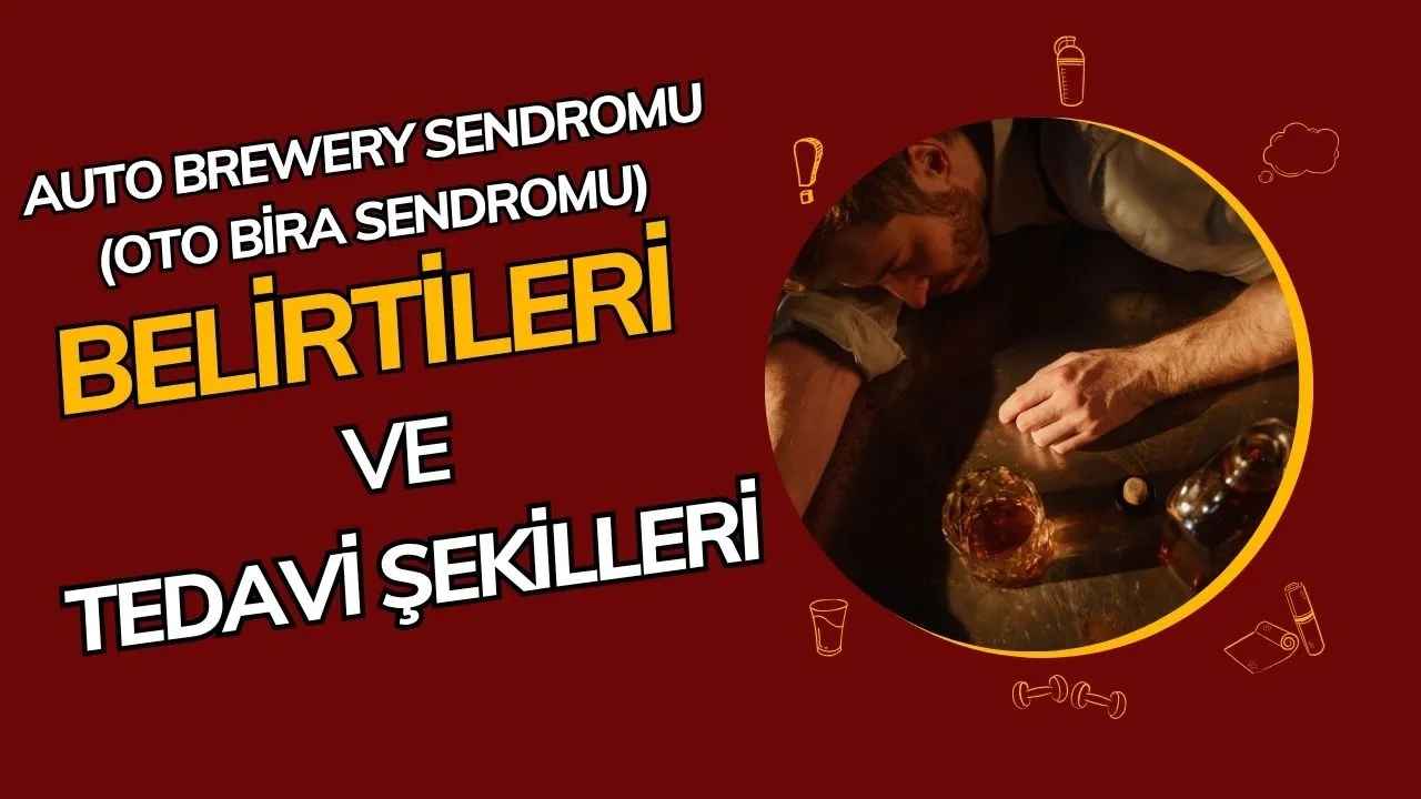 Auto Brewery Sendromu (Oto Bira Sendromu): İçmeden Sarhoş Eden Nadir Hastalık