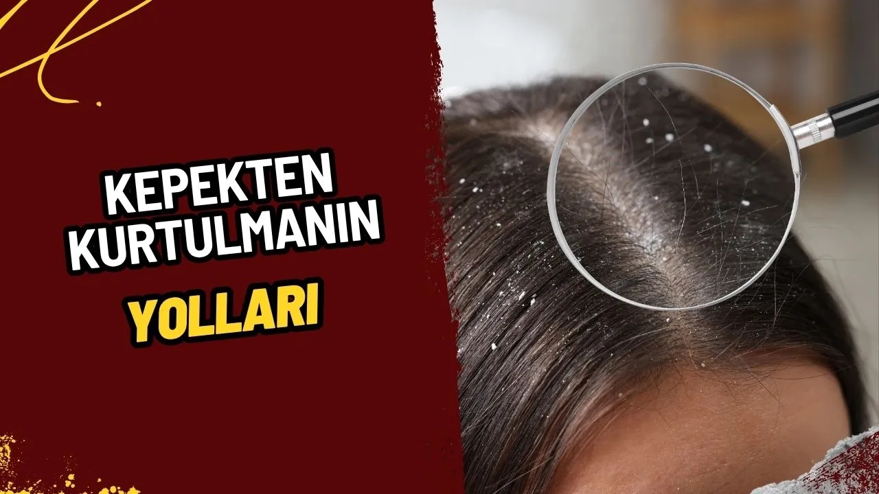 Kepekten Kurtulmanın Yolları: Sağlıklı Saç Derisi İçin Kesin Çözümler ve Doğal Yöntemler