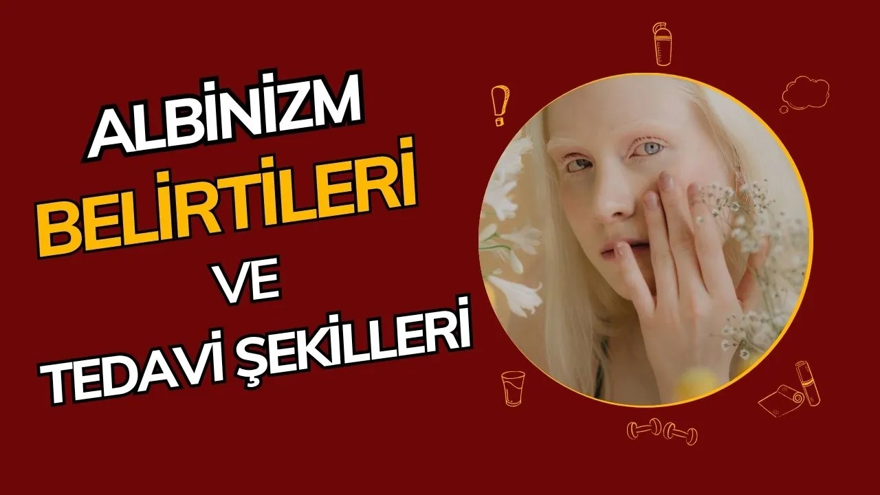 Albinizm Nedir? Belirtileri, Nedenleri ve Yaşam Kalitesi!