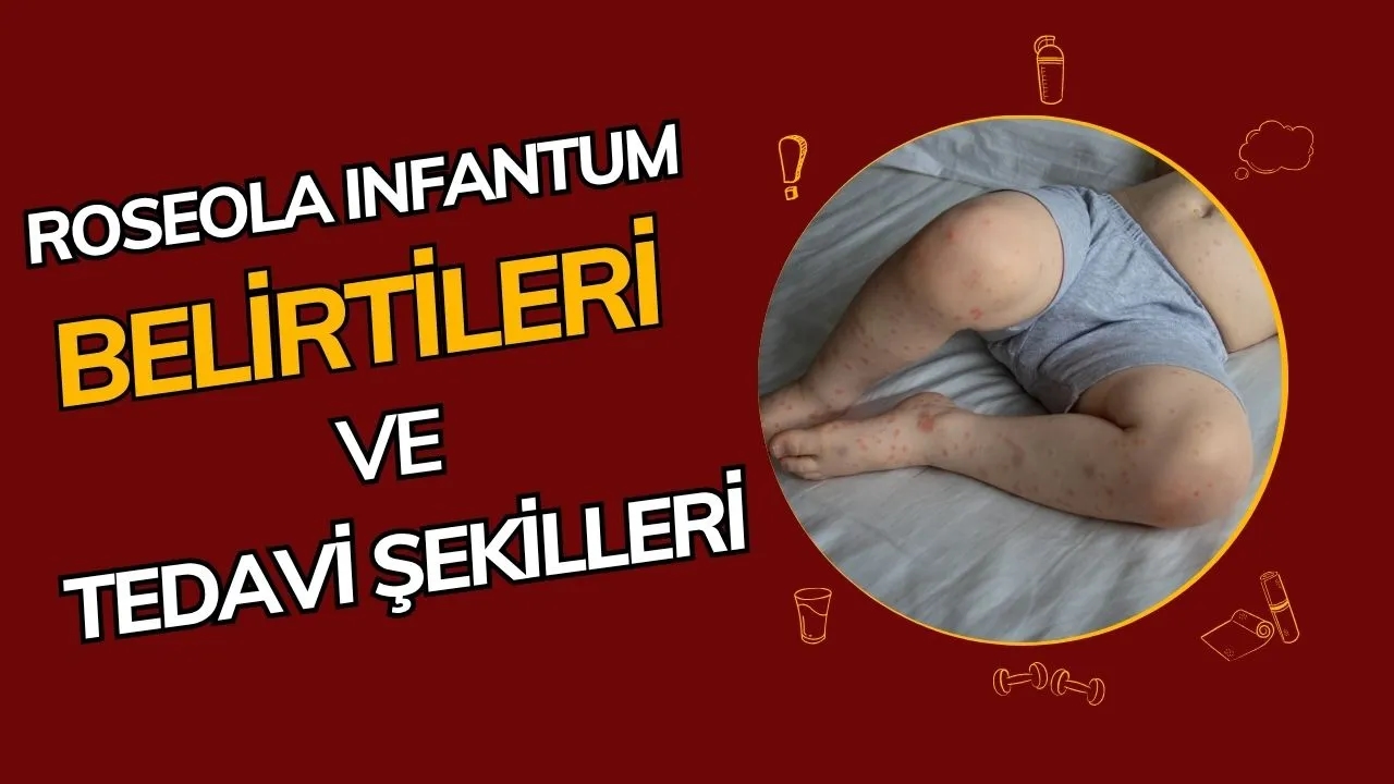 Altıncı Hastalık (Roseola Infantum): Çocuklarda Sık Görülen Ateşli Döküntü Hastalığı Nedir?