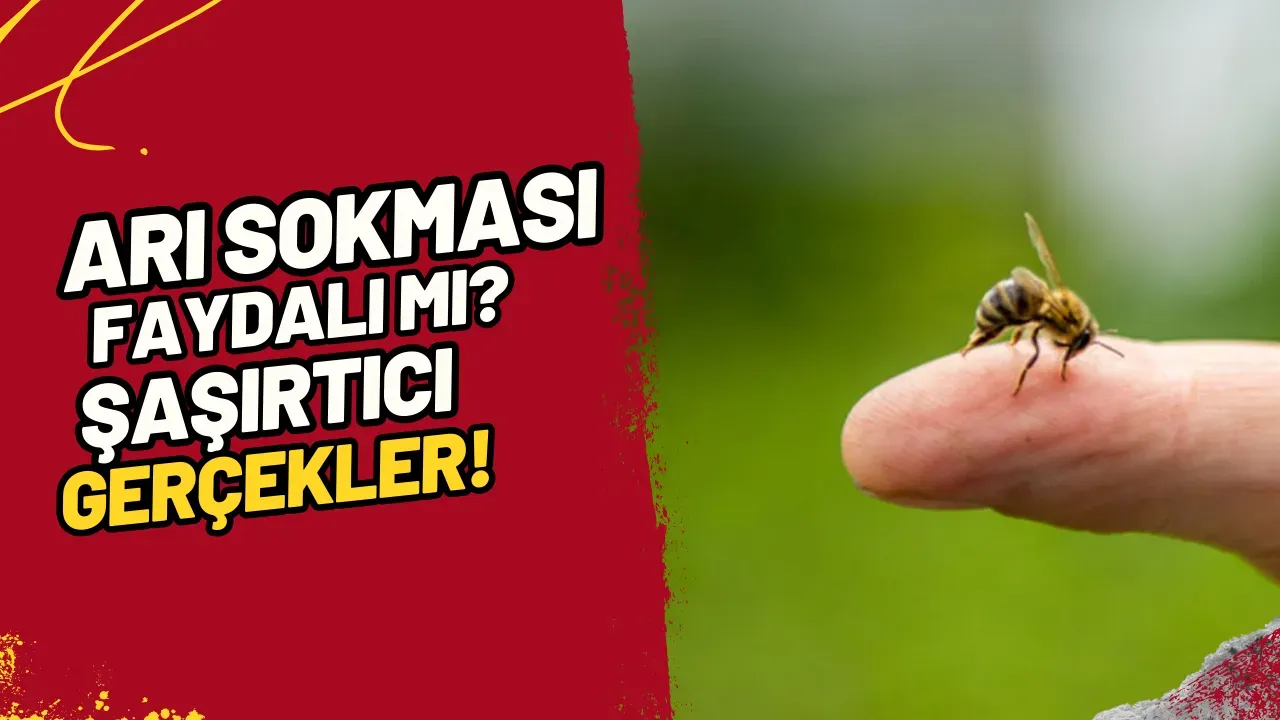 Image for Arı Sokması Faydalı mı? Şaşırtıcı Gerçekler!