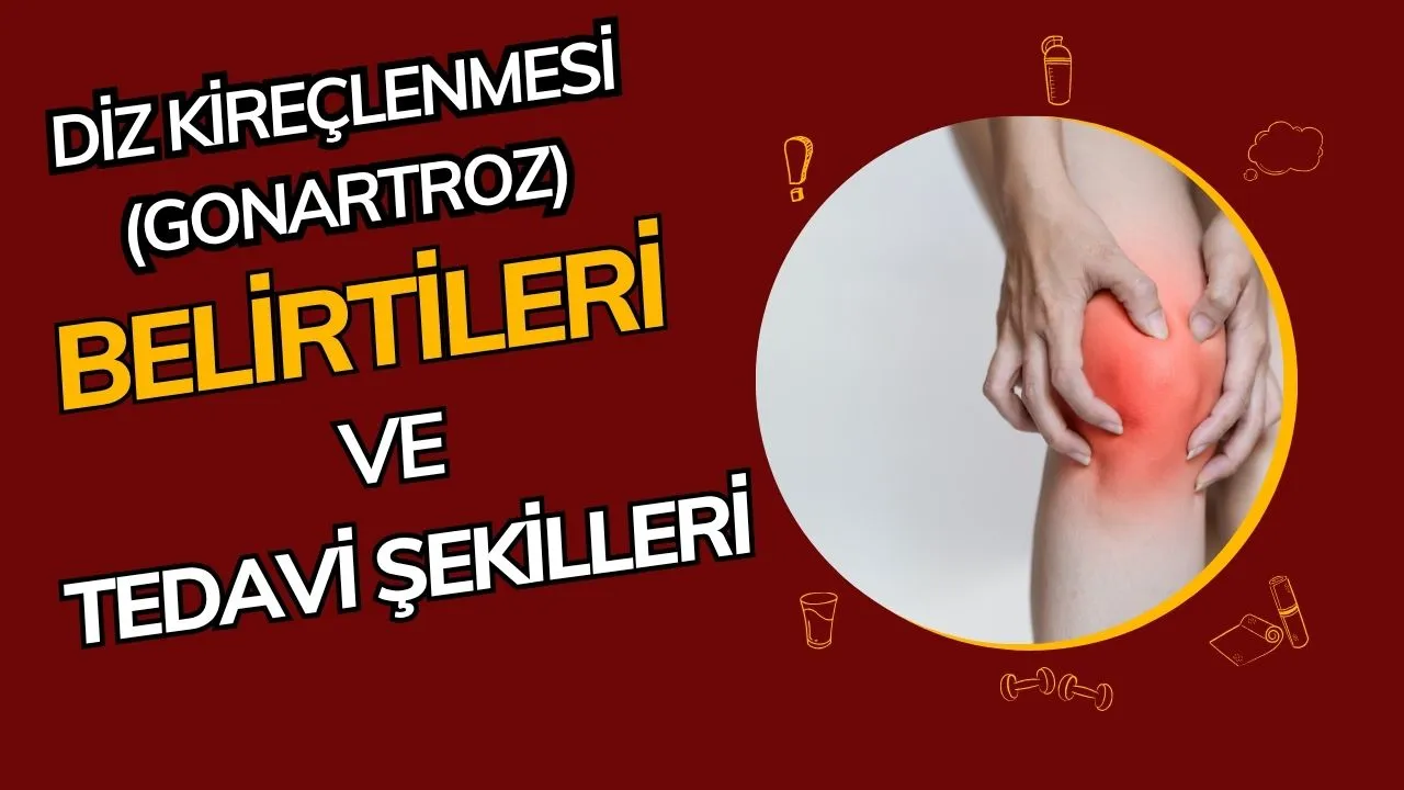 Diz Kireçlenmesi (Gonartroz): Nedenleri, Belirtileri ve Güncel Tedaviler