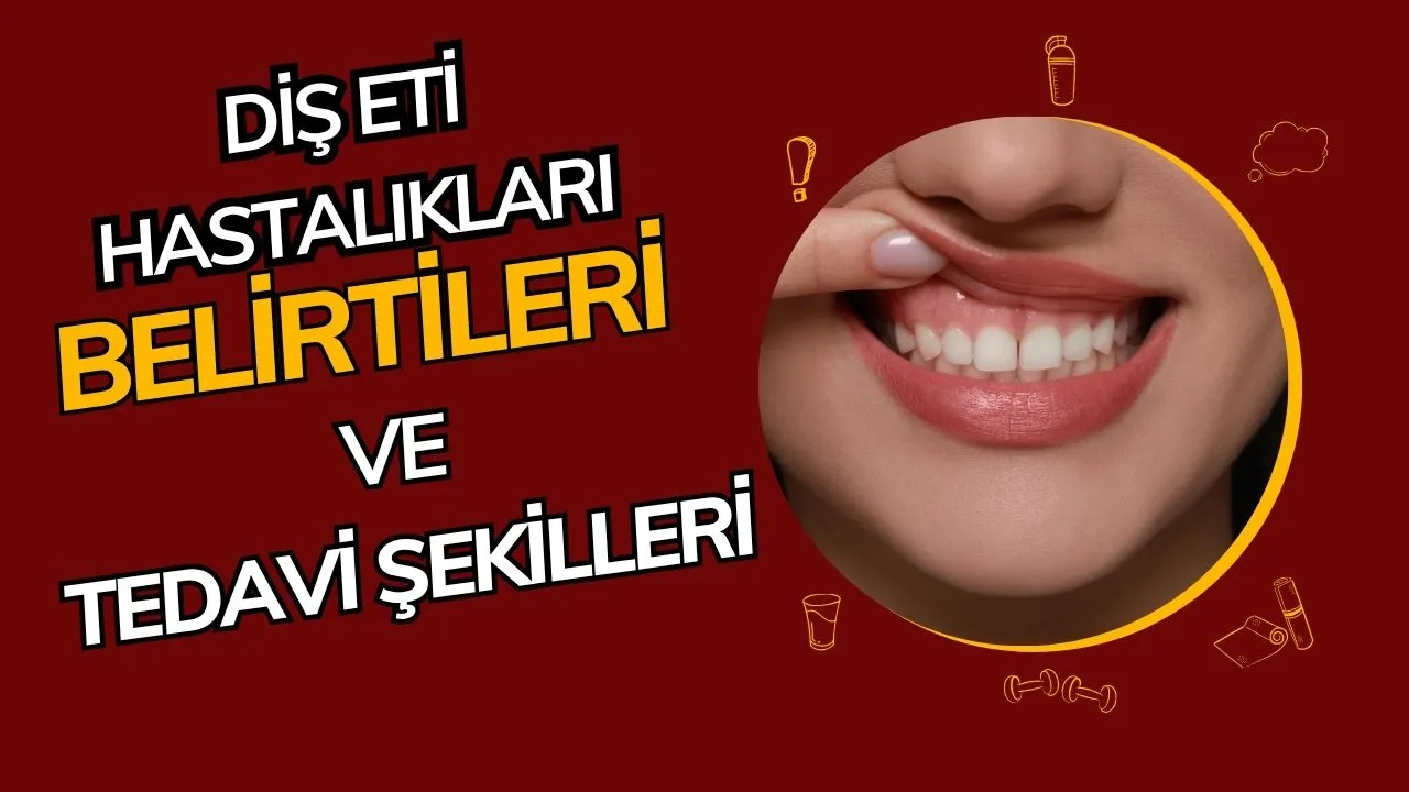 Diş Eti Hastalıkları: Belirtileri, Nedenleri ve Tedavi Yöntemleri