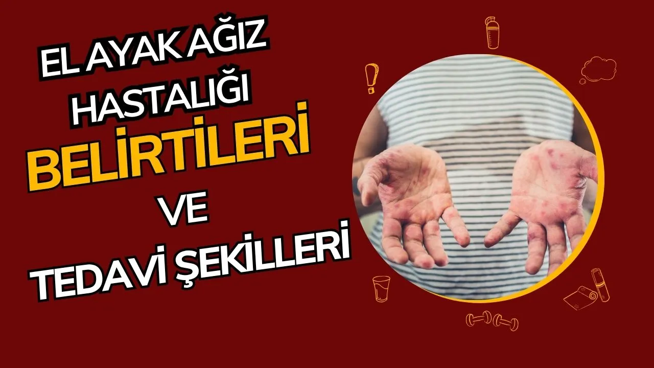 El Ayak Ağız Hastalığı: Çocuklarda Sık Görülen Ama Genellikle Hafif Seyreden Virüs Enfeksiyonu