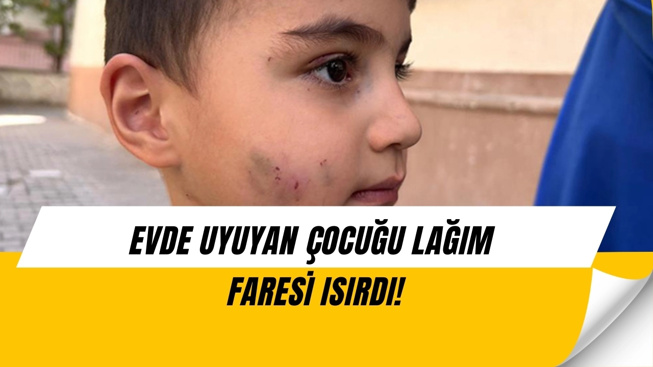 Sincan’da Dehşet! Evde Uyuyan Çocuğu Lağım Faresi Isırdı, Kuduz Aşısı Yapıldı