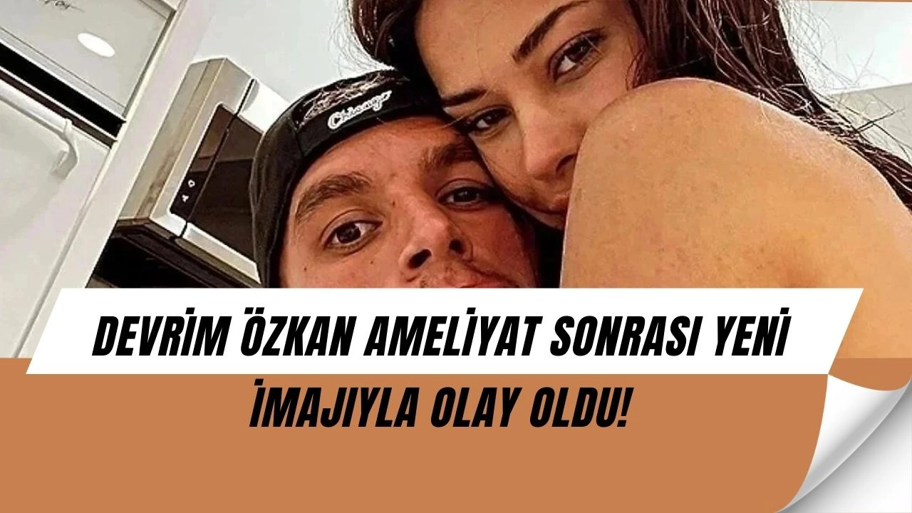 Devrim Özkan Ameliyat Sonrası Ortaya Çıktı! Yeni İmajıyla Herkesi Şaşırttı