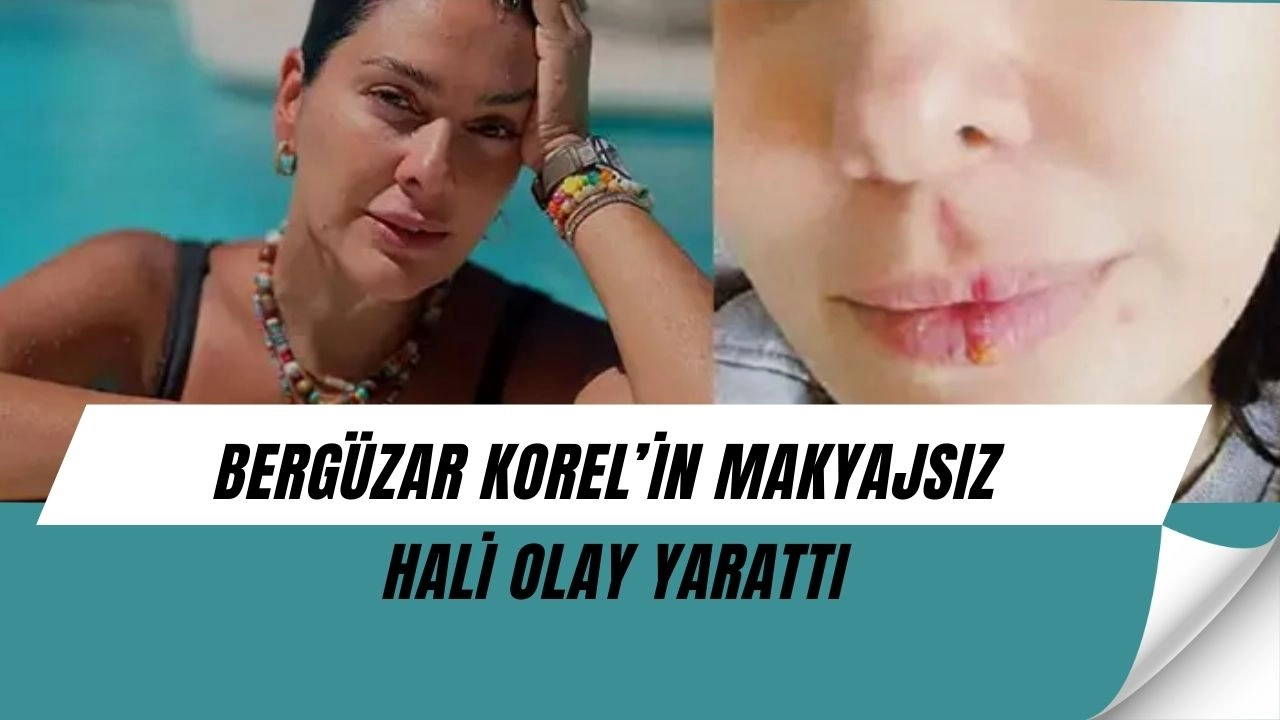 Bergüzar Korel makyajsız halini paylaştı: Sivilceler ve uçuk dikkat çekti!