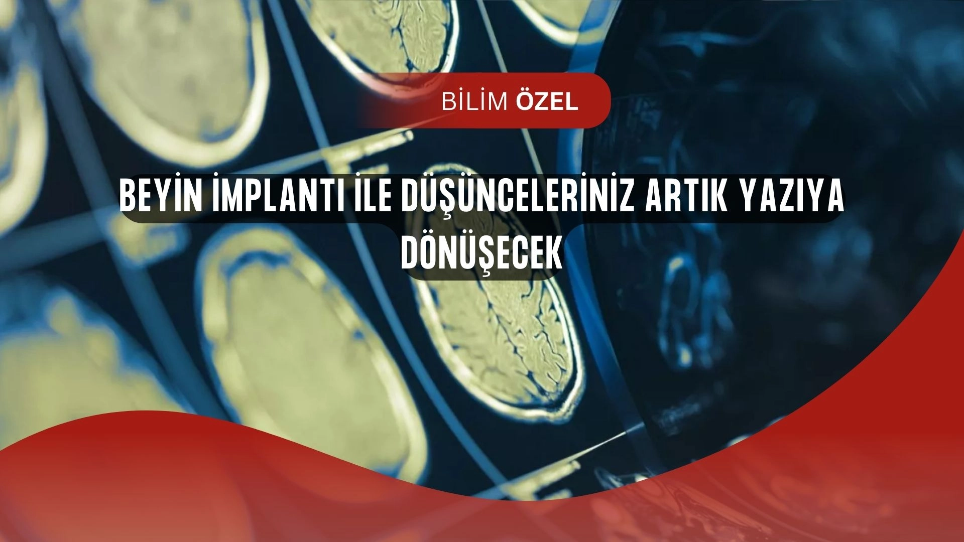 Bilim Kurgu Gerçek Oldu! Düşündüğünüz Cümleleri Yazıya Çeviren İmplant Tanıtıldı