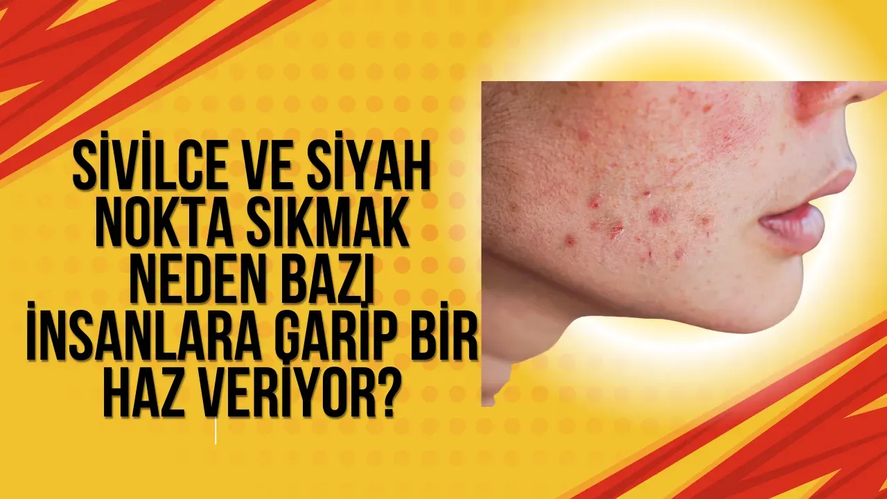 Image for Sivilce ve Siyah Nokta Sıkmak Neden Bazı İnsanlara Garip Bir Haz Veriyor?