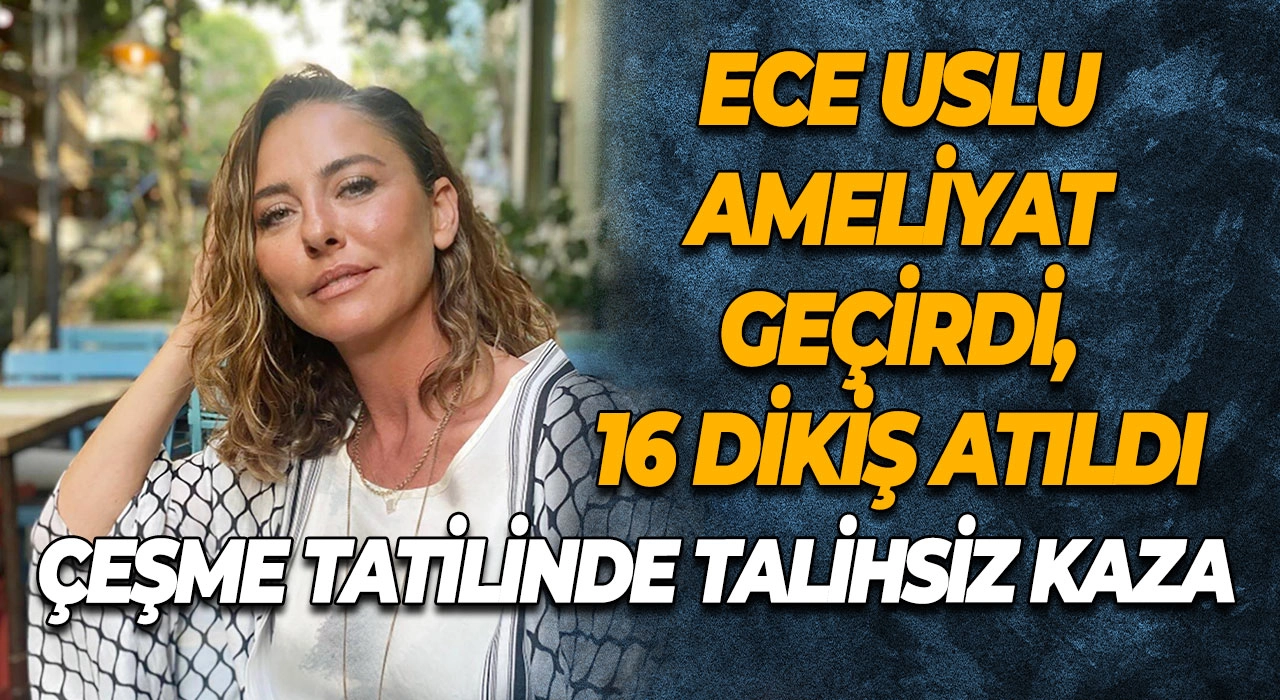 Çeşme Tatilinde Talihsiz Kaza Ece Uslu Ameliyat Geçirdi, 16 Dikiş Atıldı