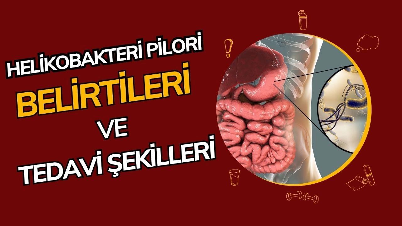 Helikobakter Pilori (H. Pylori): Mide Sağlığının Sinsi Düşmanı ve Tedavi Yöntemleri