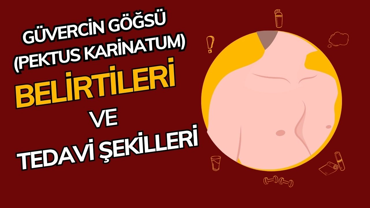 Güvercin Göğsü (Pektus Karİnatum): Estetik ve Sağlık Sorunlarına Yol Açan Göğüs Deformitesi