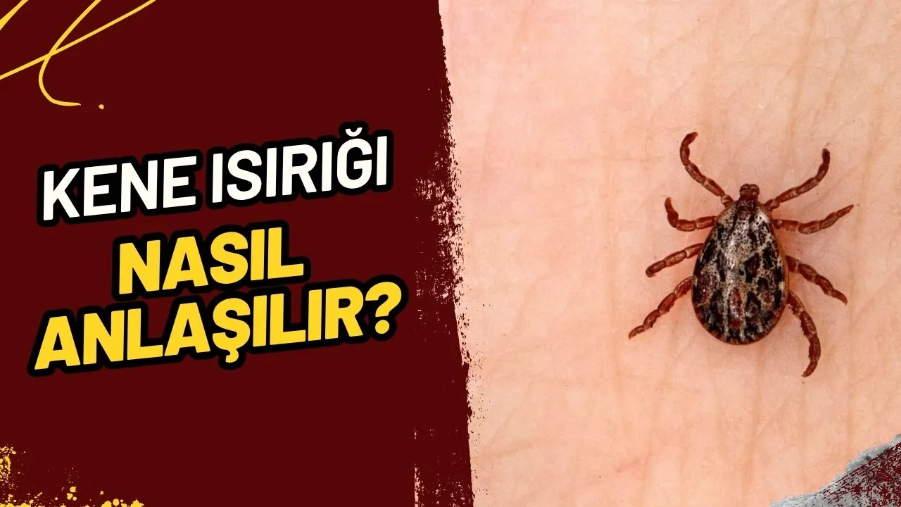 Kene Isırığı Nasıl Anlaşılır ve Kene Isırırsa Ne Yapmalı? Hayati Bilgiler!