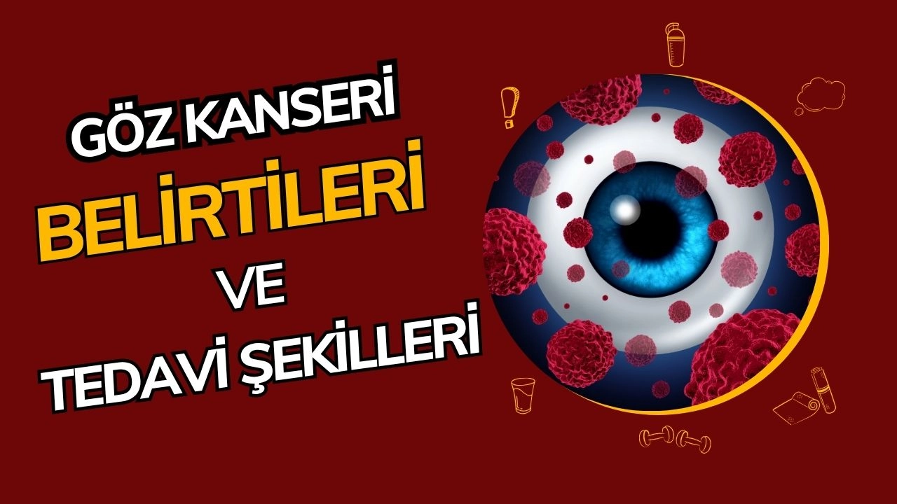 Göz Kanseri: Göz Sağlığını Tehdit Eden Sinsi Bir Tehlike