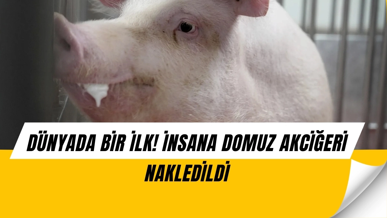 Bilim Dünyası Şokta! İnsan Bedenine İlk Kez Domuz Akciğeri Nakledildi 9 Gün Çalıştı