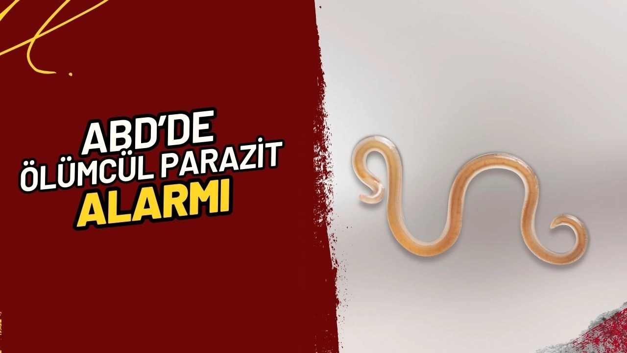 Ölümcül Parazit Alarmı! Vücuda Sızıp İnsanlarla Besleniyor! ABD'de 'Sessiz Katil' Tehlikesi