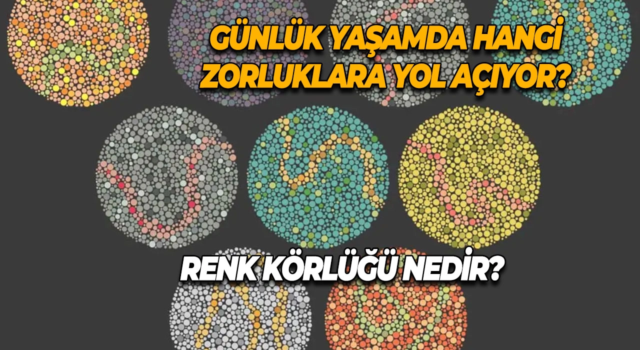 Renk Körlüğü Nedir? Günlük Yaşamda Hangi Zorluklara Yol Açıyor?