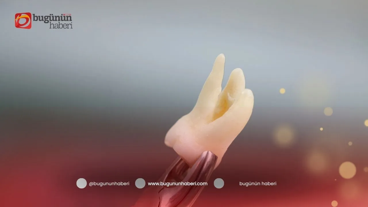 Media content