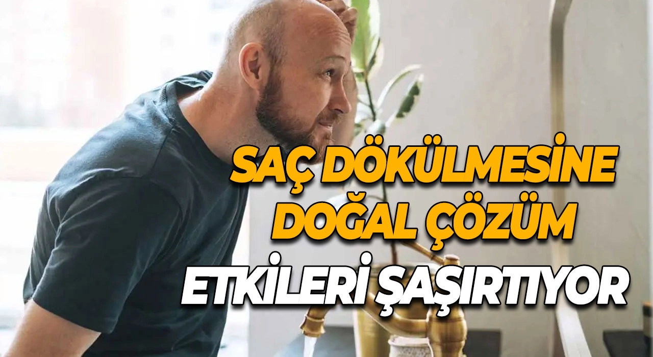 Saç Dökülmesine Doğal Çözüm Etkileri Şaşırtıyor Bakın Neden Tercih Ediliyor